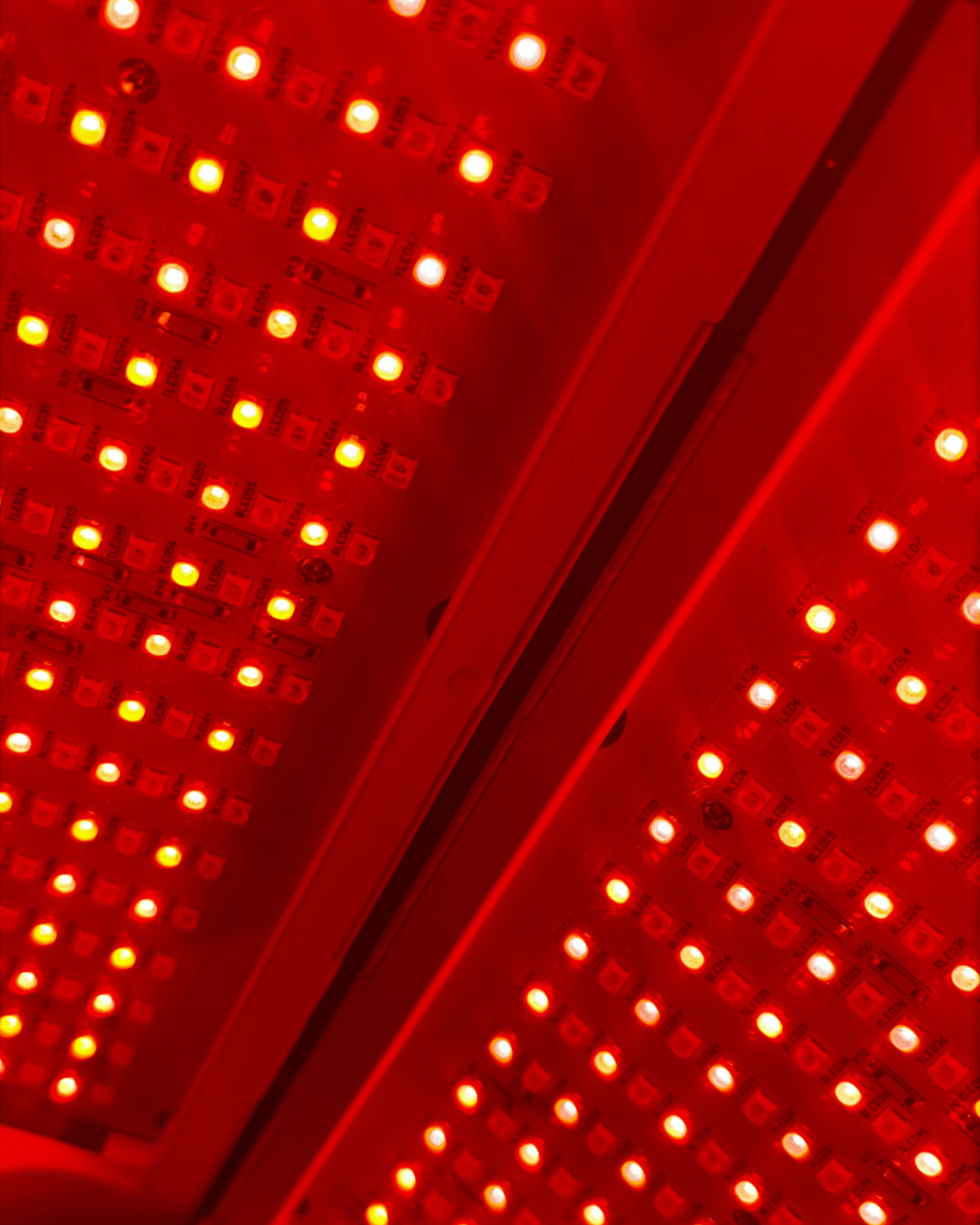 Low-Level Light Therapy - A New Era in Dry Eye and Eyelid Health