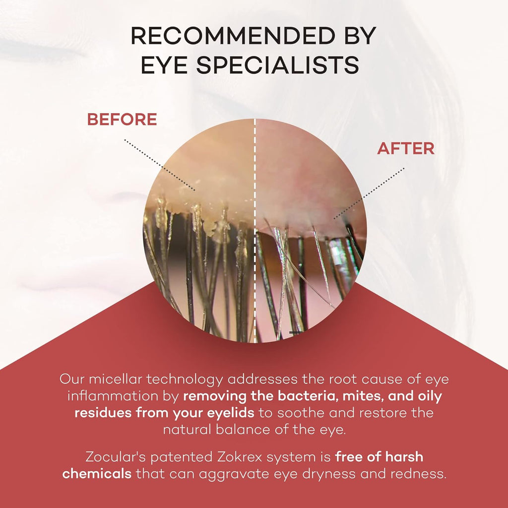 Zocushield Gel (10ml)
