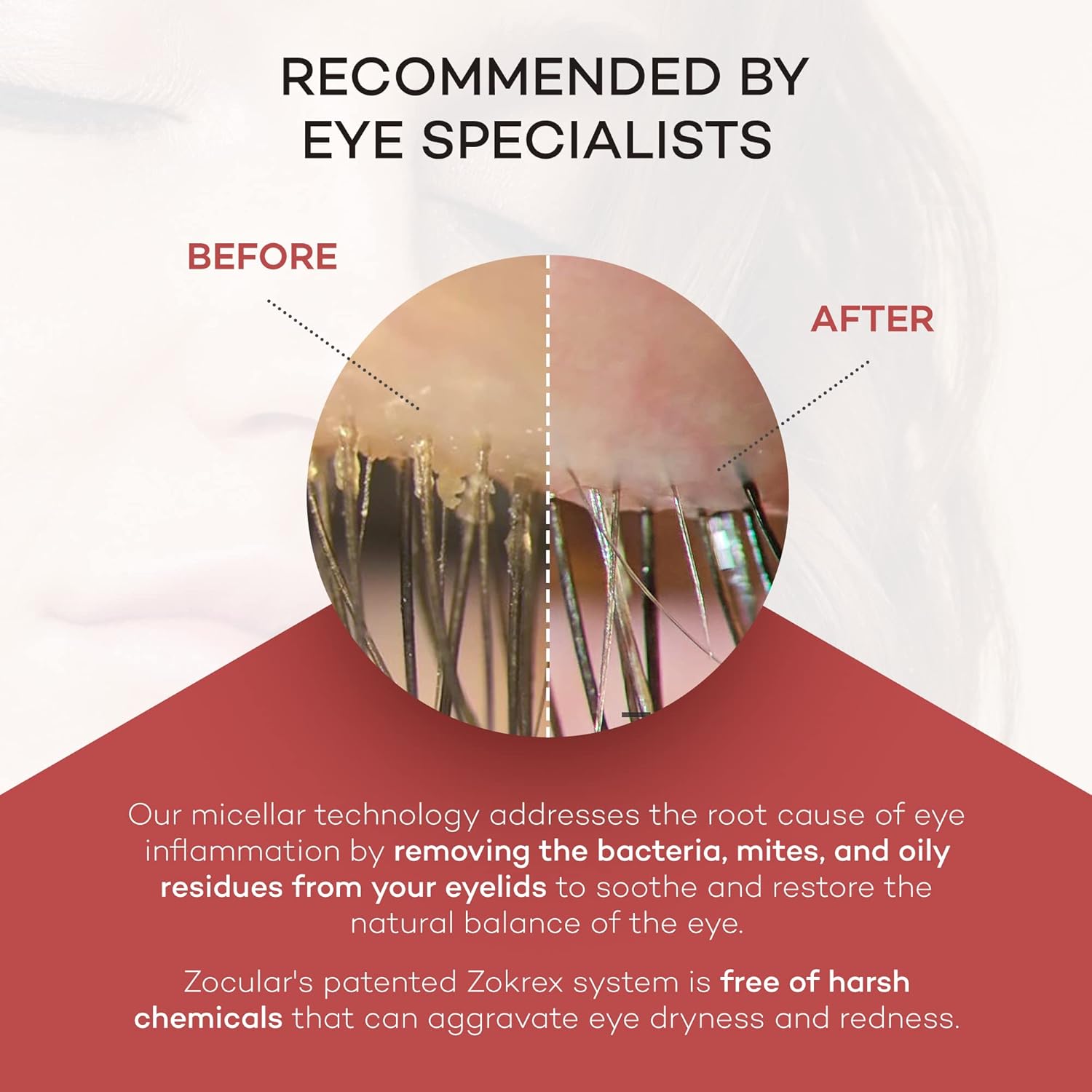 Zocushield Gel (10ml)