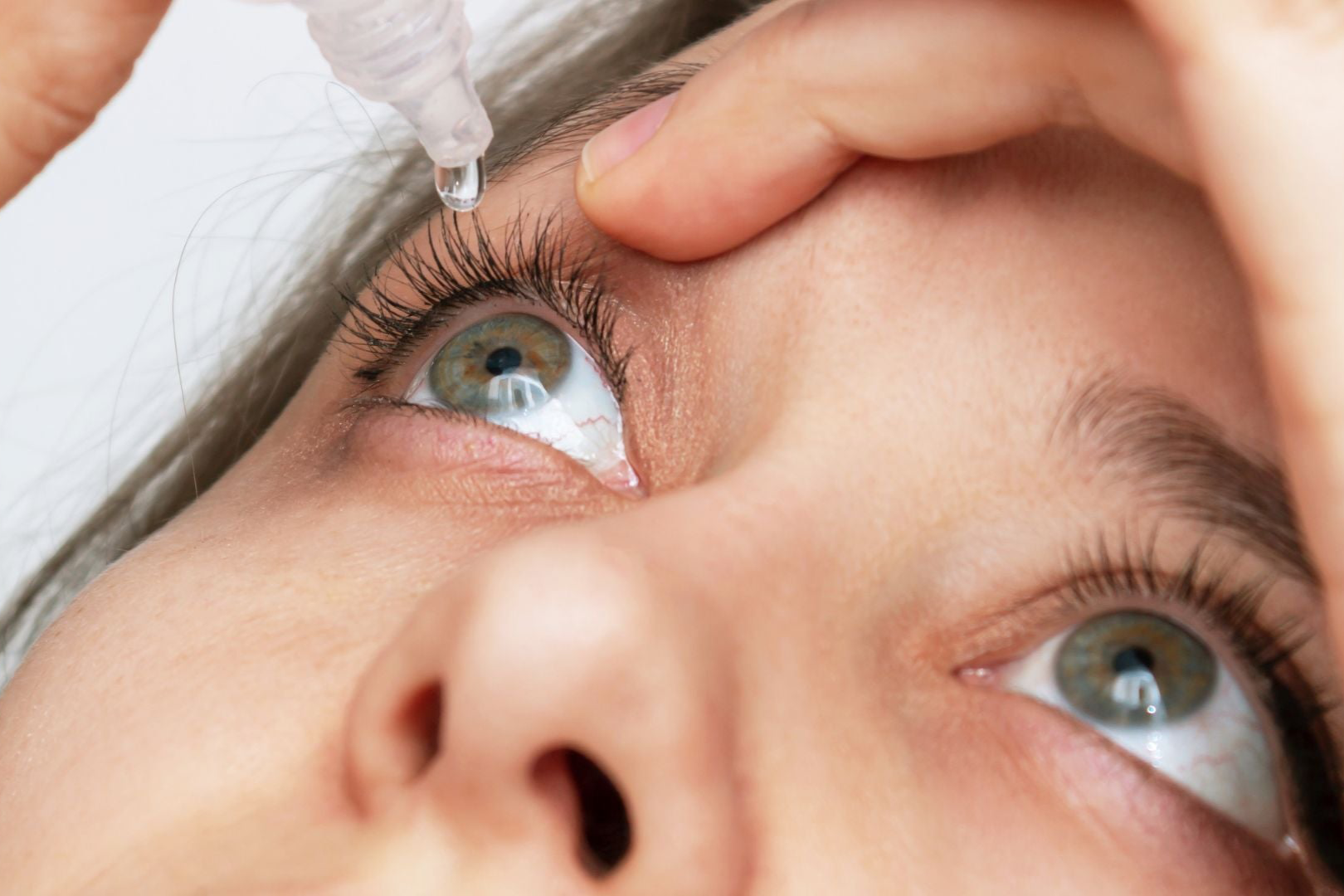 Person applying eye drops to their eye with a close-up view.