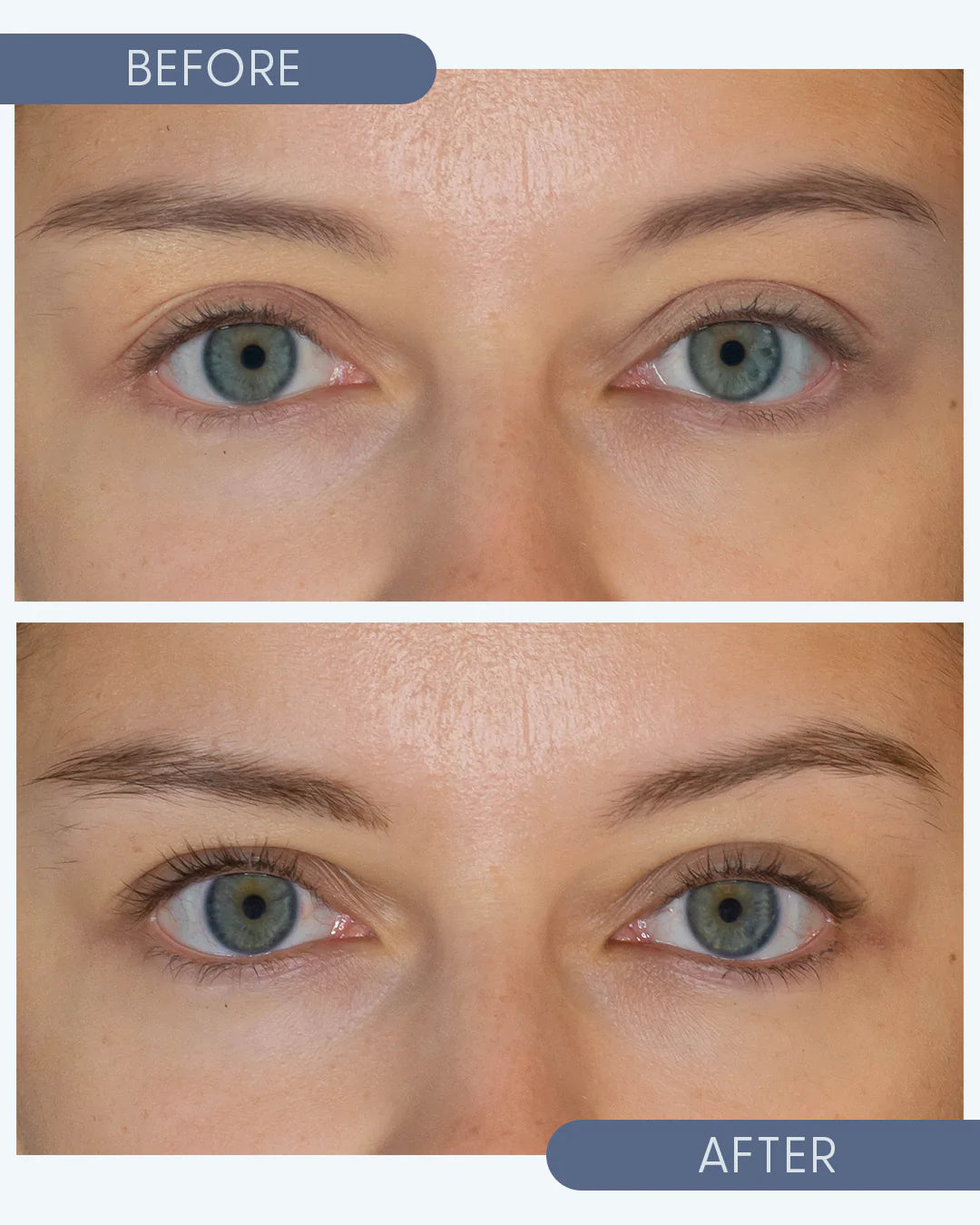 Twenty/Twenty Beauty Growing Lash & Brow Serum (10ml)