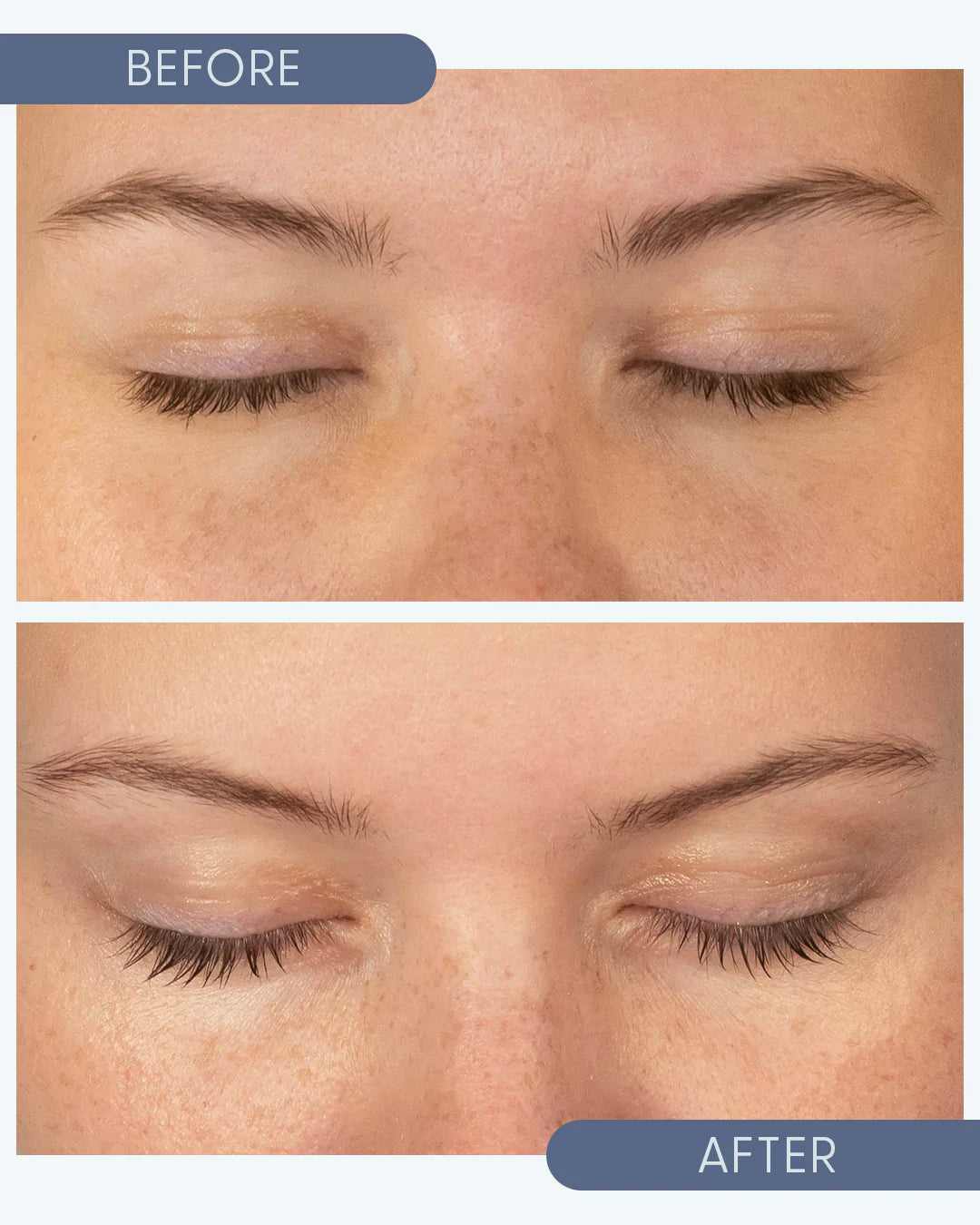 Twenty/Twenty Beauty Growing Lash & Brow Serum (10ml)